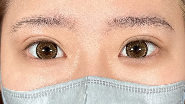 Postoperative Condition Part 1