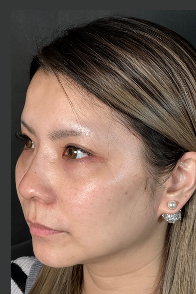 Postoperative Condition Part 1