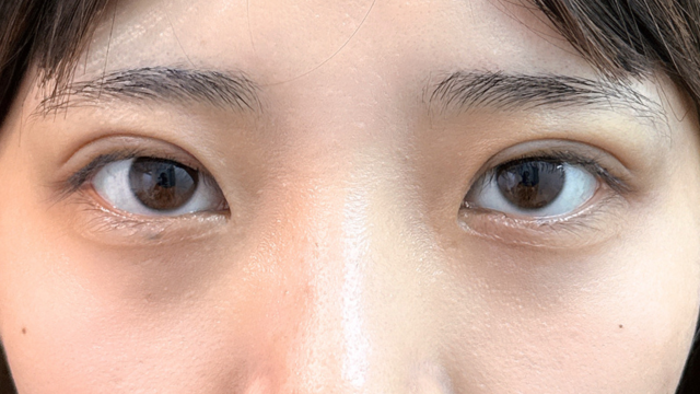 Postoperative Condition Part 1