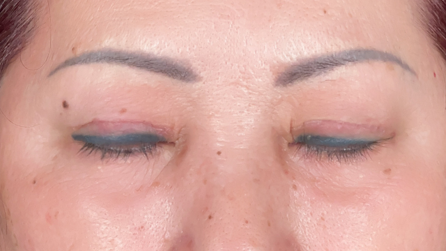 Postoperative Condition Part 1