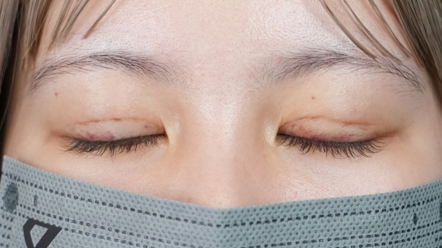 Postoperative Condition Part 1