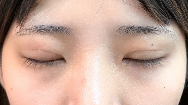 Postoperative Condition Part 1