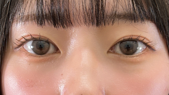 Postoperative Condition Part 1