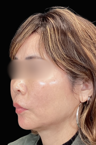 Postoperative Condition Part 1