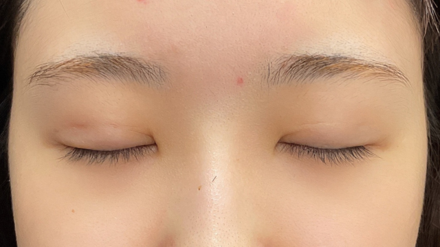 Postoperative Condition Part 1