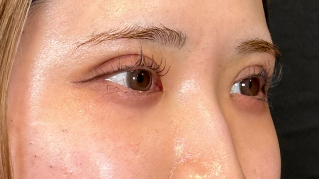 Postoperative Condition Part 1