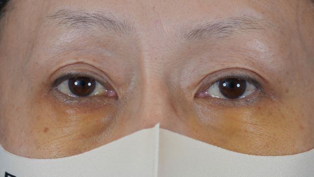 Postoperative Condition Part 1