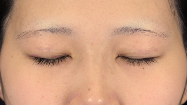 Postoperative Condition Part 1