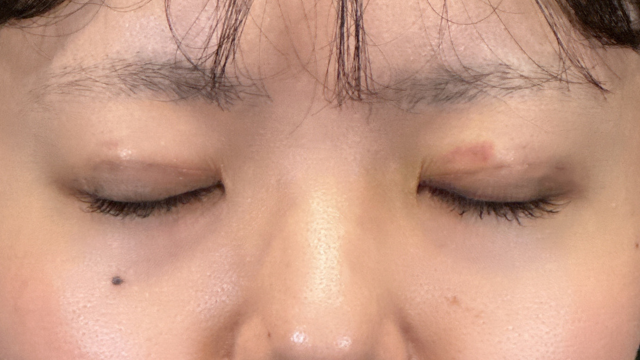 Postoperative Condition Part 1