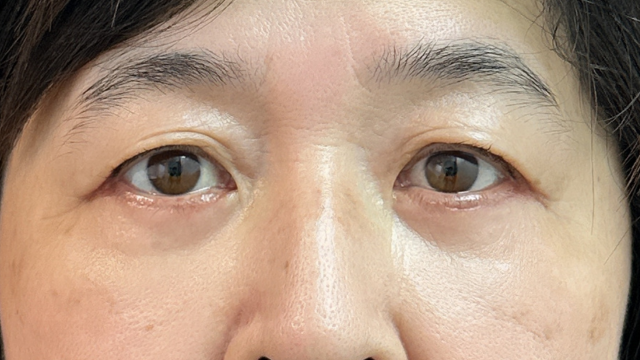 Postoperative Condition Part 1