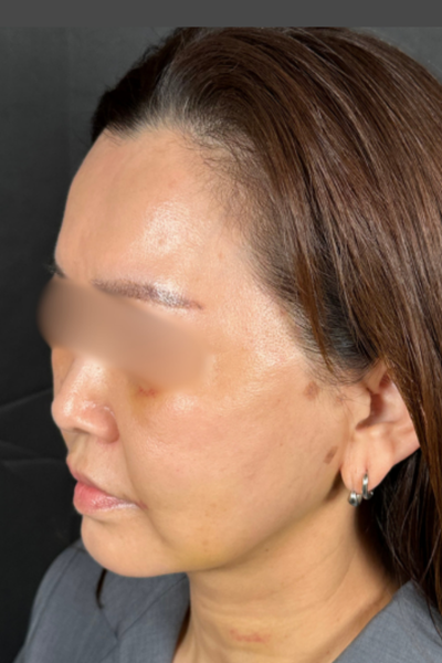 Postoperative Condition Part 1