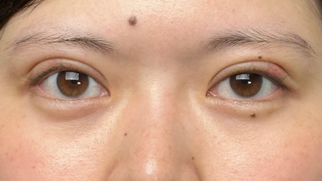 Postoperative Condition Part 1