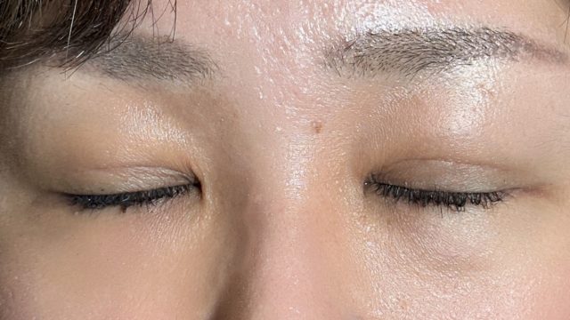 Postoperative Condition Part 1