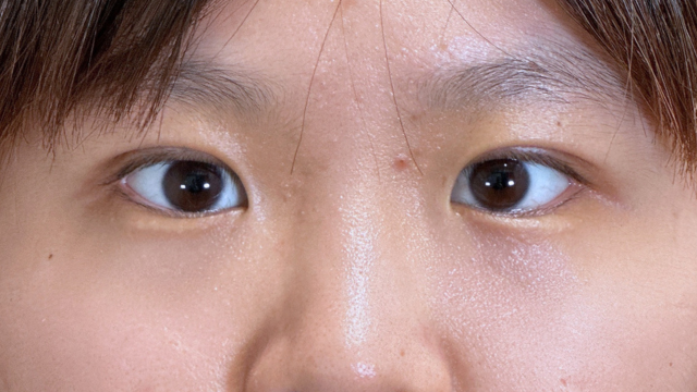 Postoperative Condition Part 1