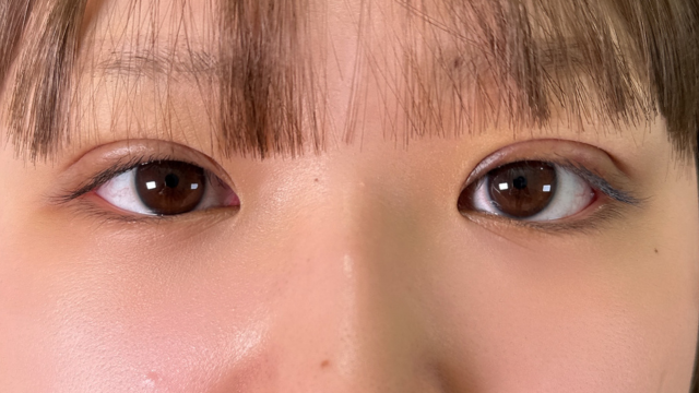 Postoperative Condition Part 1