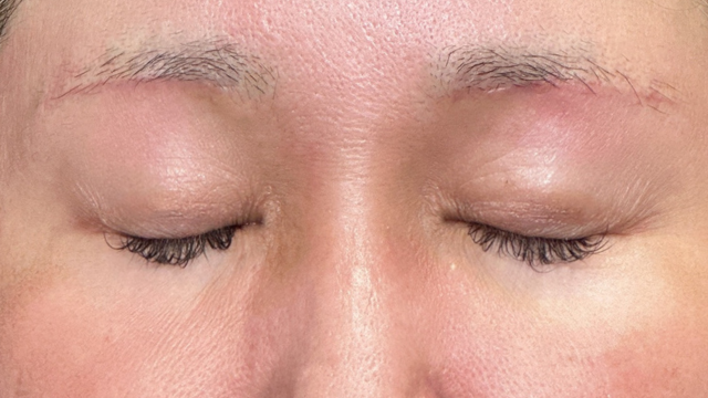 Postoperative Condition Part 1