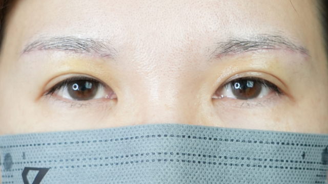 Postoperative Condition Part 1