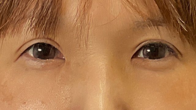 Postoperative Condition Part 1