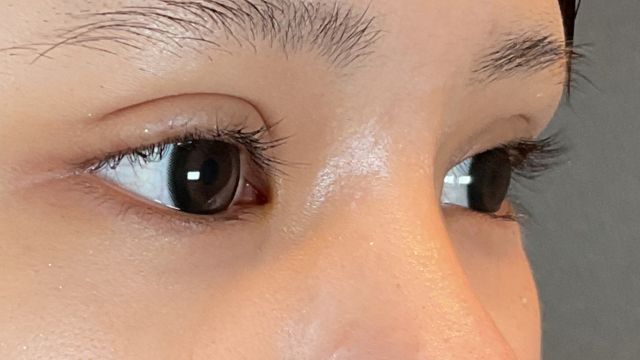 Postoperative Condition Part 1