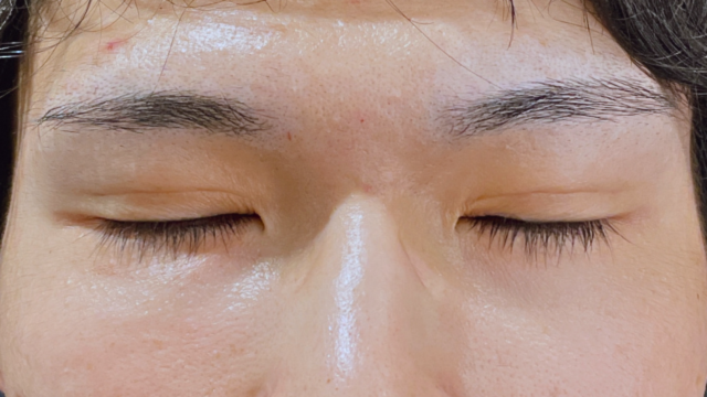 Postoperative Condition Part 1