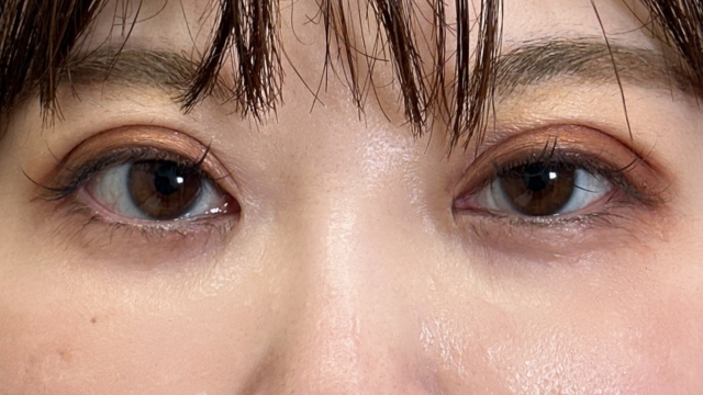 Postoperative Condition Part 1