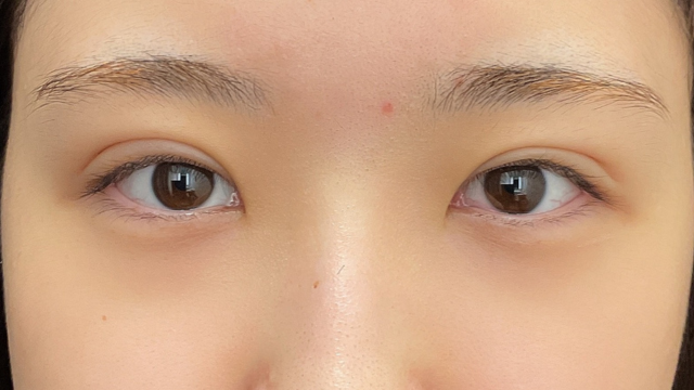 Postoperative Condition Part 1