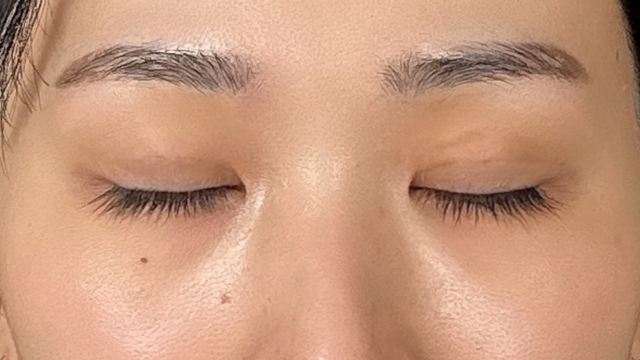 Postoperative Condition Part 1