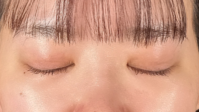 Postoperative Condition Part 1