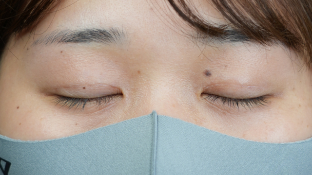 Postoperative Condition Part 1