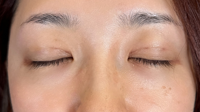 Postoperative Condition Part 1