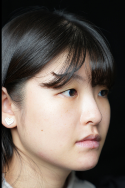 Postoperative Condition Part 1