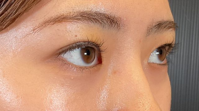 Postoperative Condition Part 1