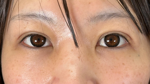 Postoperative Condition Part 1