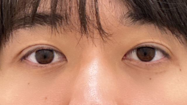 Postoperative Condition Part 1