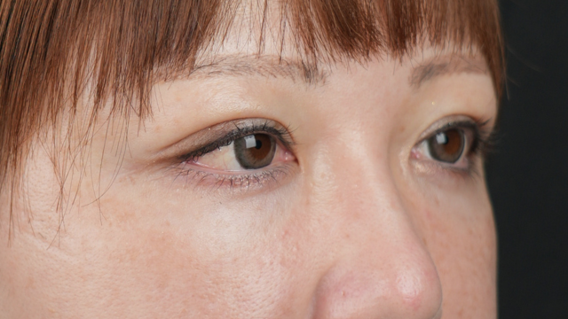 Postoperative Condition Part 1