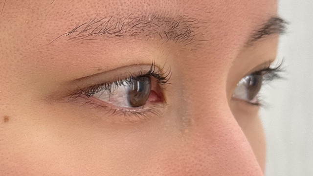 Postoperative Condition Part 1