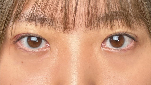 Postoperative Condition Part 1