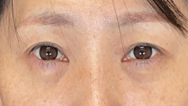 Postoperative Condition Part 1