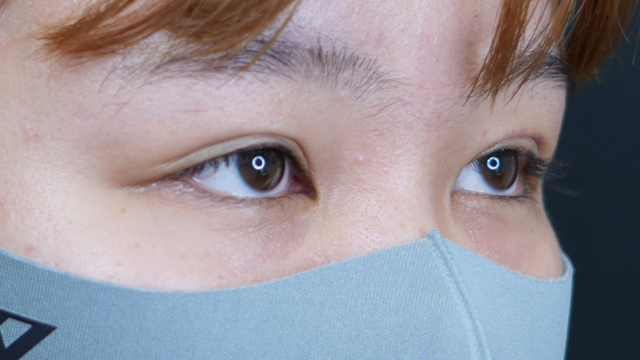 Postoperative Condition Part 1