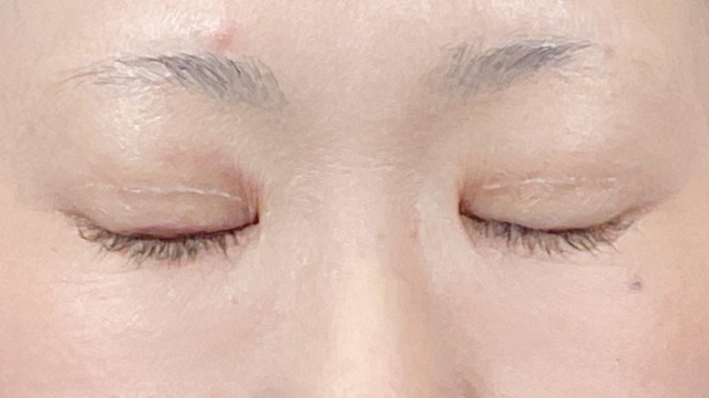 Postoperative Condition Part 1