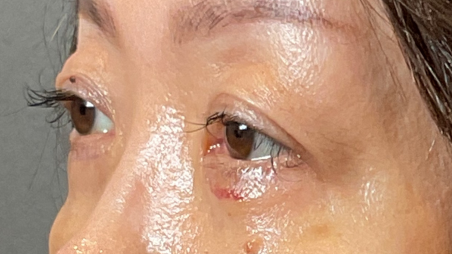 Postoperative Condition Part 1