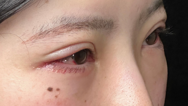 Postoperative Condition Part 1