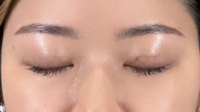 Postoperative Condition Part 1