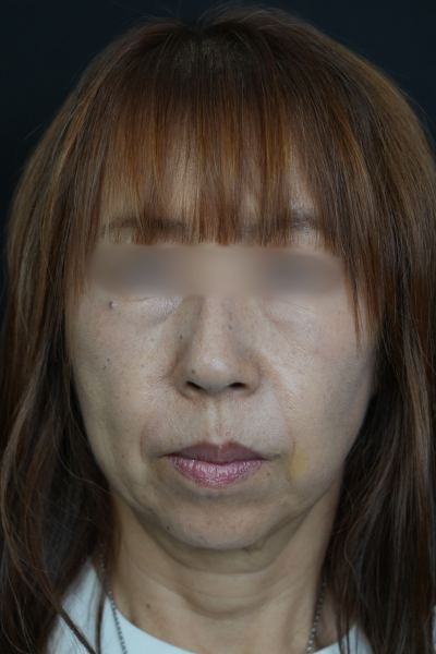 Postoperative Condition Part 1