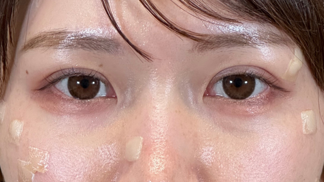 Postoperative Condition Part 1