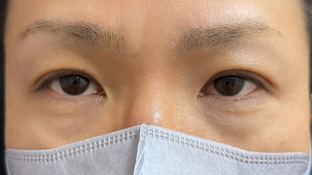 Postoperative Condition Part 1