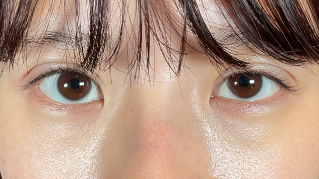 Postoperative Condition Part 1