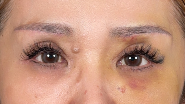 Postoperative Condition Part 1