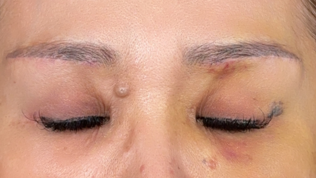 Postoperative Condition Part 1