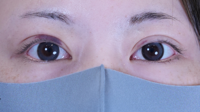 Postoperative Condition Part 1